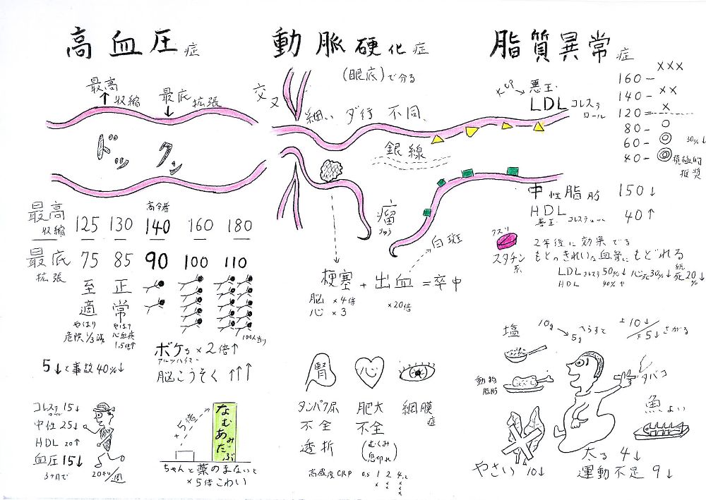 動脈硬化