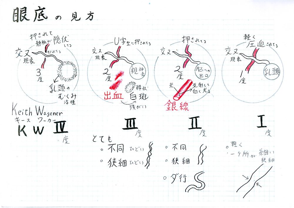 眼底の見方