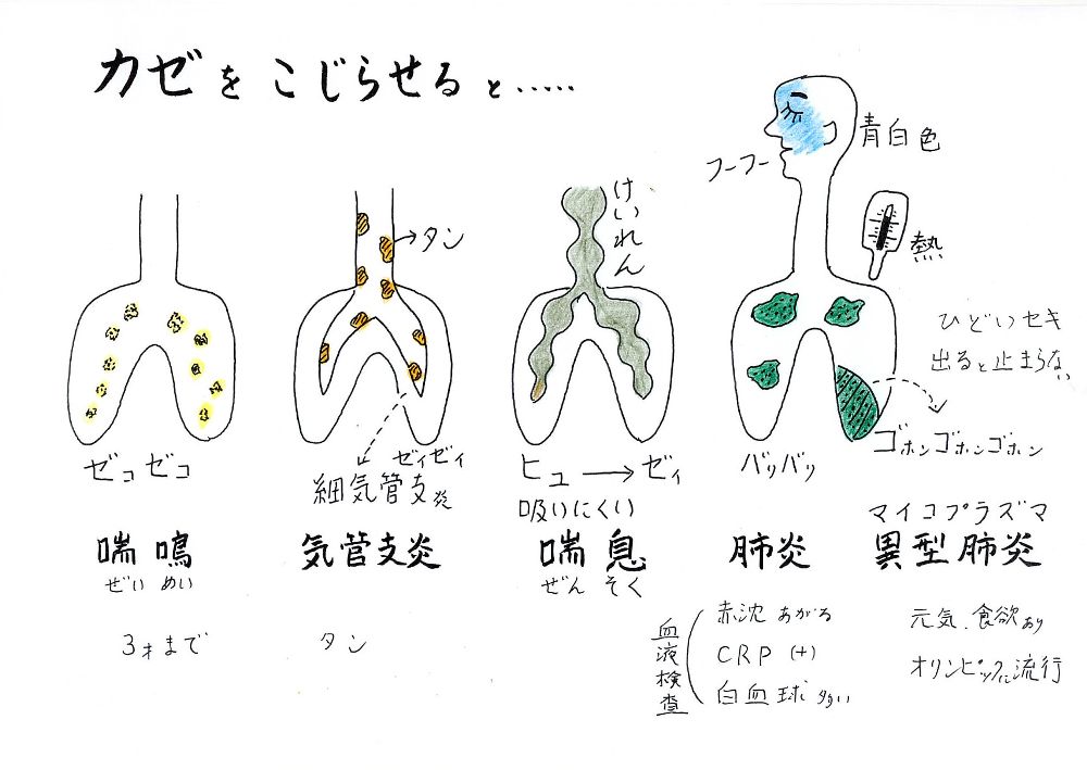 風邪をこじらせると